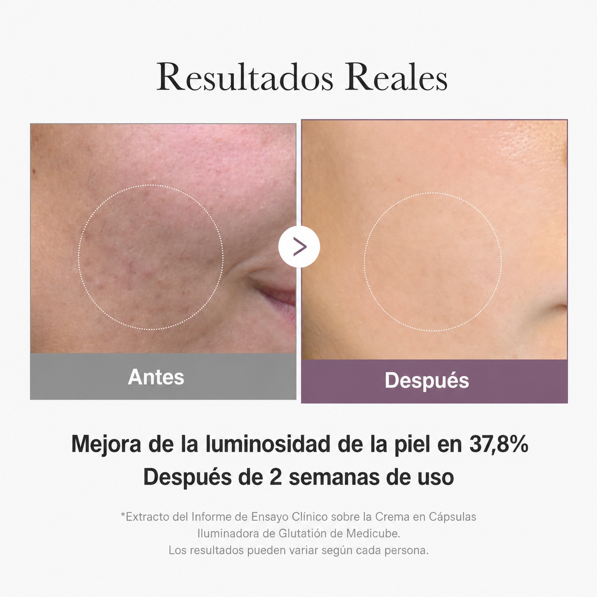 Crema en cápsulas Medicube Age-R con glutatión para un brillo radiante 50ml